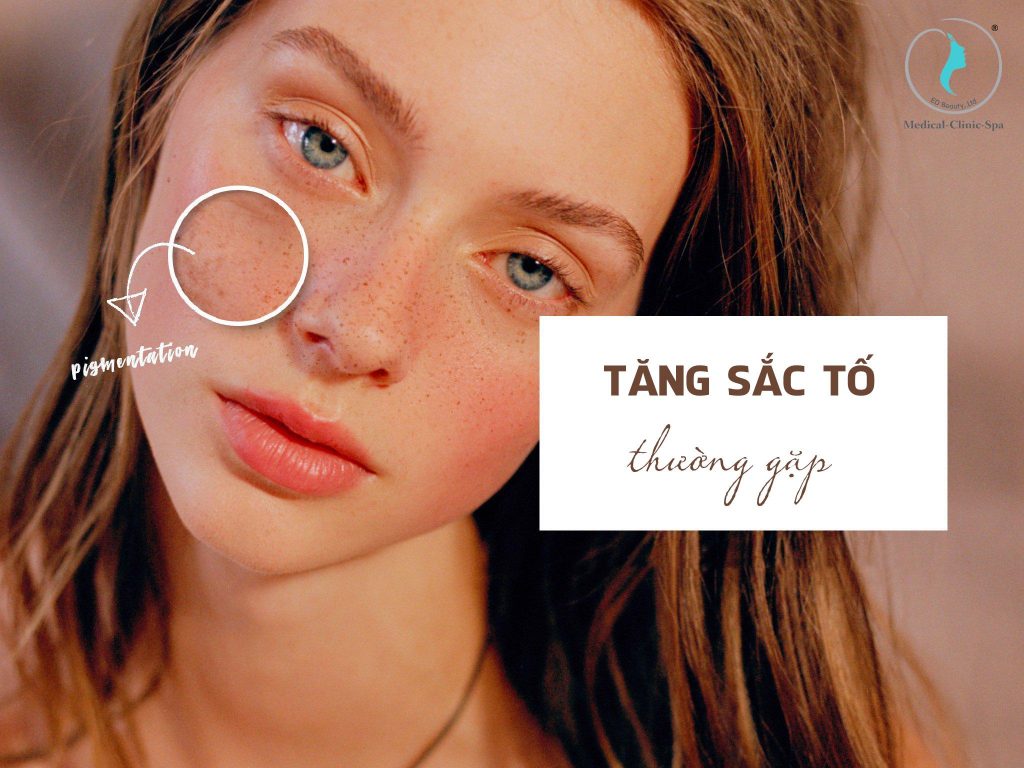 Các loại tăng sắc tố thường gặp